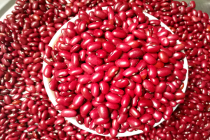 Frijoles rojos from Etiopía